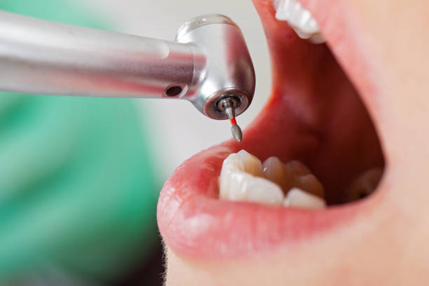Best Walk-In Emergency Dental Services in Montara, CA